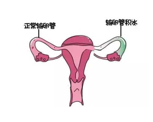 泰国试管代怀上户口,[辽阳三代试管婴儿成功率多久]宫外孕去泰国做试管费用，