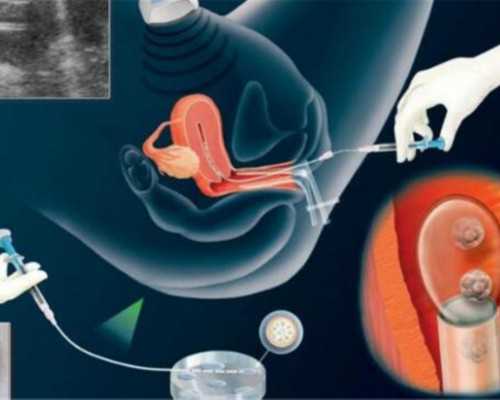 泰国高龄供卵助孕,泰国试管婴儿宝宝身体好吗?
