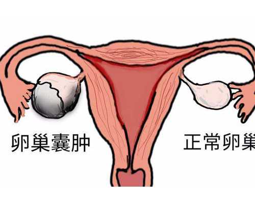 泰国代孕网产子价格,泰国试管是否需要准生证？