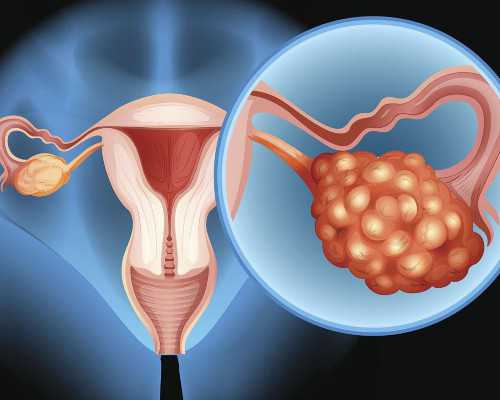 泰国代孕网的优质,泰国试管婴儿适应症有几种？