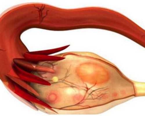 泰国三甲供卵医院,泰国试管婴儿龙凤胎要哪些条件？