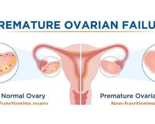 泰国代怀孕官网,泰国试管婴儿危害大?都是误区!
