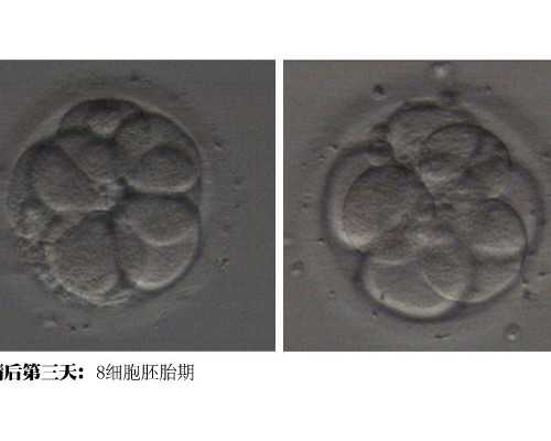 泰国代孕供卵医院,香港三代试管和泰国三代试管技术，应该怎么选？