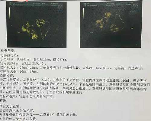 泰国试管婴儿卵子不好能成功吗,泰国女王苏提达有几个子女？