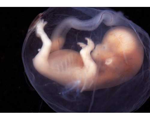 泰国代孕套餐价格,泰国试管婴儿移植有多痛?