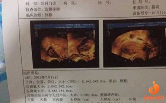 博尔塔拉56岁供卵试管婴儿的成功率_博尔塔拉49岁自卵和赠卵成功率_上海中山医